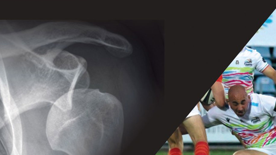 Convegno sui traumi alla spalla negli sport da contatto